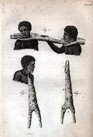 [Methods and instruments of restraint, plate III] [graphic].