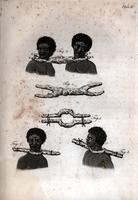 [Methods and instruments of restraint, plate II] [graphic].